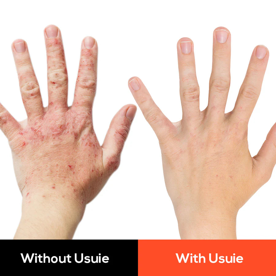 USUIE Red Light Infrared Therapy Device For Hand Pain Relief Glove