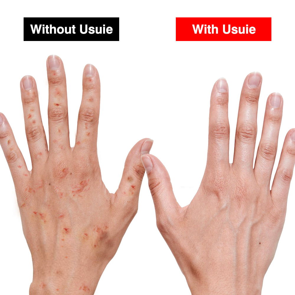 Red Light Therapy Beauty Glove