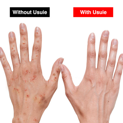 Red Light Therapy Beauty Glove